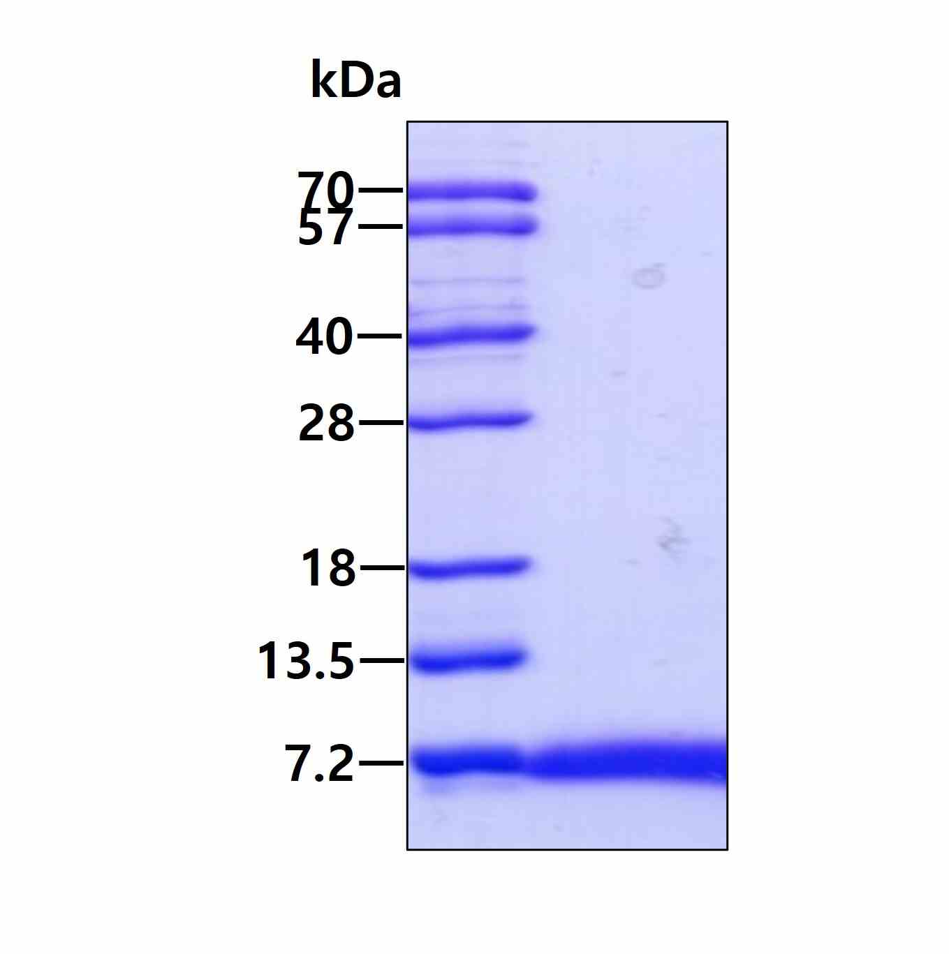 3 μg by SDS-PAGE under reducing condition and visualized by coomassie blue stain.